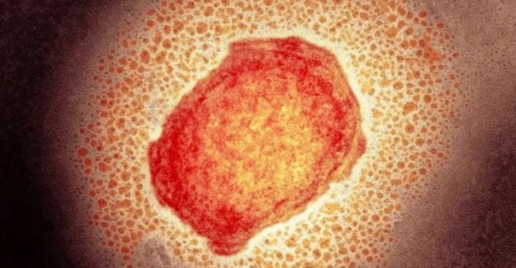 মাঙ্কিপক্স: বিএসএমএমইউ উপাচার্যের সতর্কবার্তা