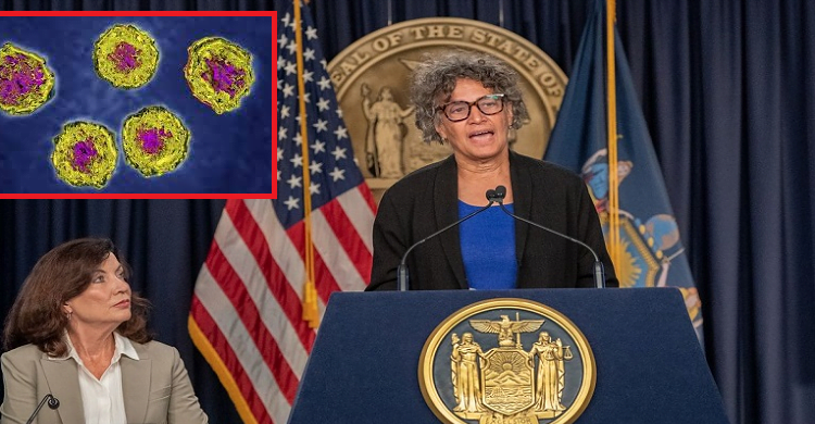 পোলিও ভাইরাস ছড়িয়ে পড়ায় নিউইয়র্কে জরুরি অবস্থা