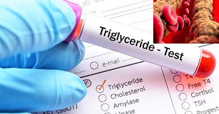 হঠাৎ ট্রাইগ্লিসারাইড বাড়ে যদি খাবার পরিবর্তনই ওষুধ